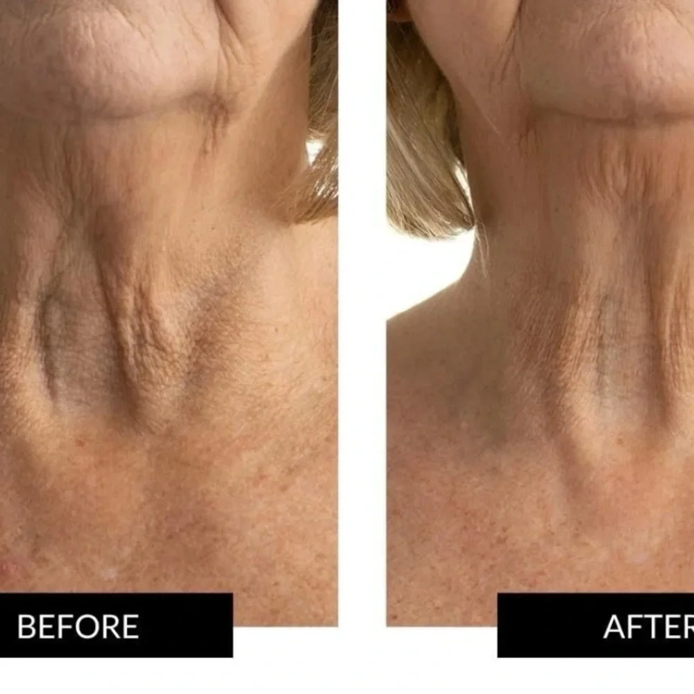 CurrentBody Skin LED Neck&Dec Perfector Fully Wearable Anti-Aging